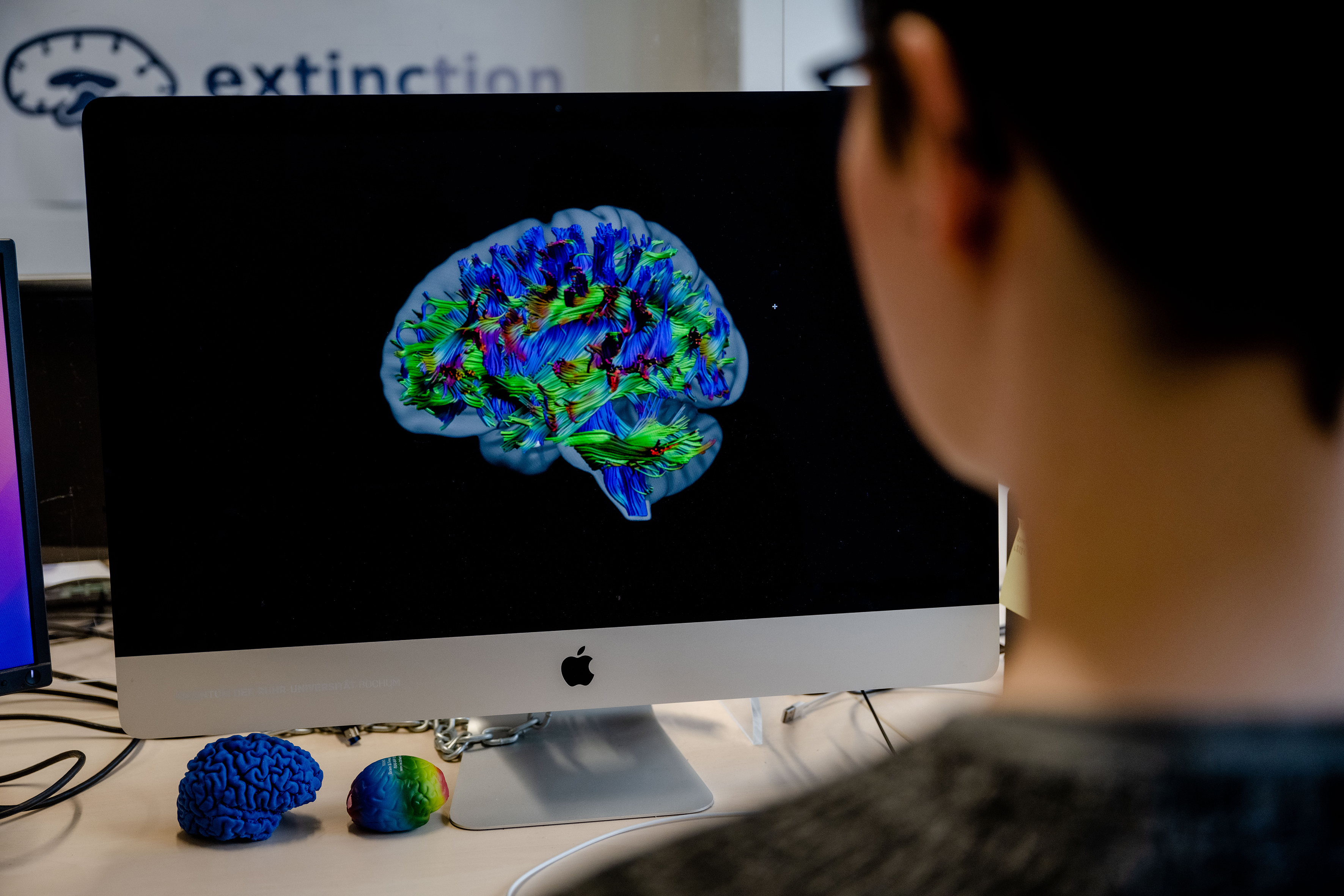 Monitor mit farbig dargestellten Faserverbindungen des Gehirns