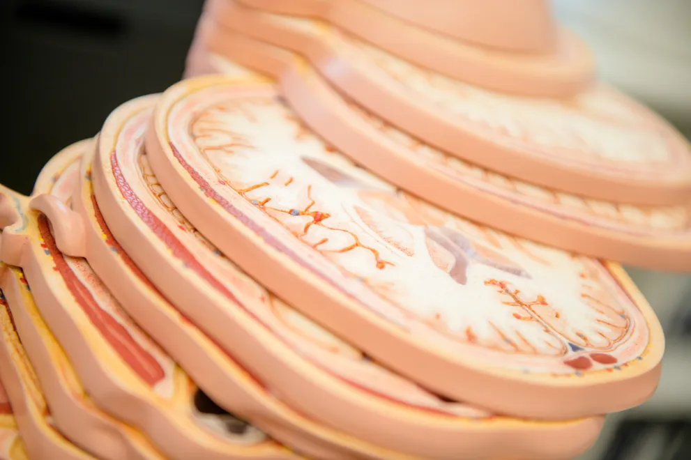 Brain model